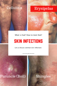 Read more about the article What’s that? & How to treat that? (Common Skin Infections)